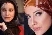 بازیگرانی که جراحی زیبایی آنها سروصدای زیادی کرد/تصاویر