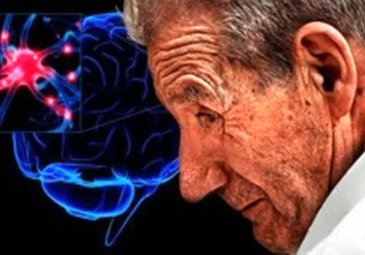 علائمی که نشان می دهد پارکینسون دارید