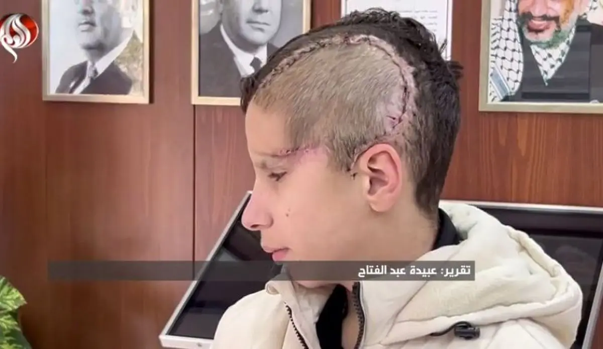 کوچک ترین اسیر فلسطینی که اشغالگران جمجمه اش را خُرد کردند+ فیلم 