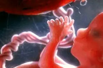 زنگ خطر افزایش سقط‌‌‌ زیرزمینی