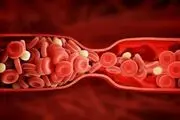 هرآنچه لازم است درباره غلظت خون بدانید