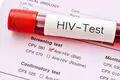 هشدار درباره تغییر الگوی انتقال HIV