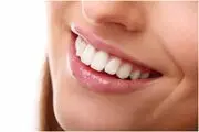 راز داشتن لبخند زیبا چیست؟