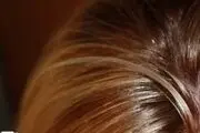 معجزه های ماءالشعیر روی موهای سر