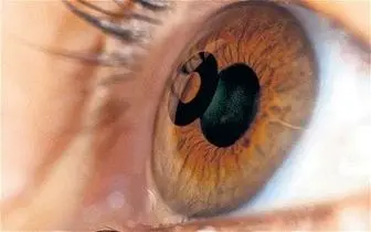 کلیدهای طلایی برای داشتن چشمانی سالم