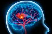 اینفوگرافیک/ عواملی که مغز را تقویت می‌کند