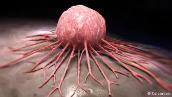نشانه‌های هشدار دهنده رشد سرطان در بدن چیست؟ 