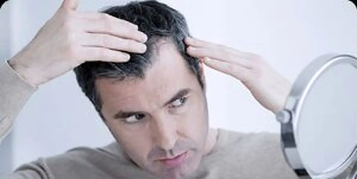 افزایش رشد مو با این خوراکیها