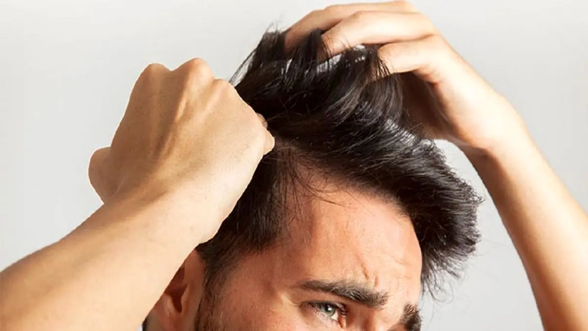 توصیههای تغذیهای برای جلوگیری از ریزش مو