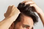 توصیه‌های تغذیه‌ای برای جلوگیری از ریزش مو
