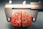 مغز انسان در حال بزرگ‌تر شدن است
