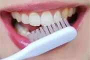 سفید شدن رنگ لثه به چه دلیل است؟