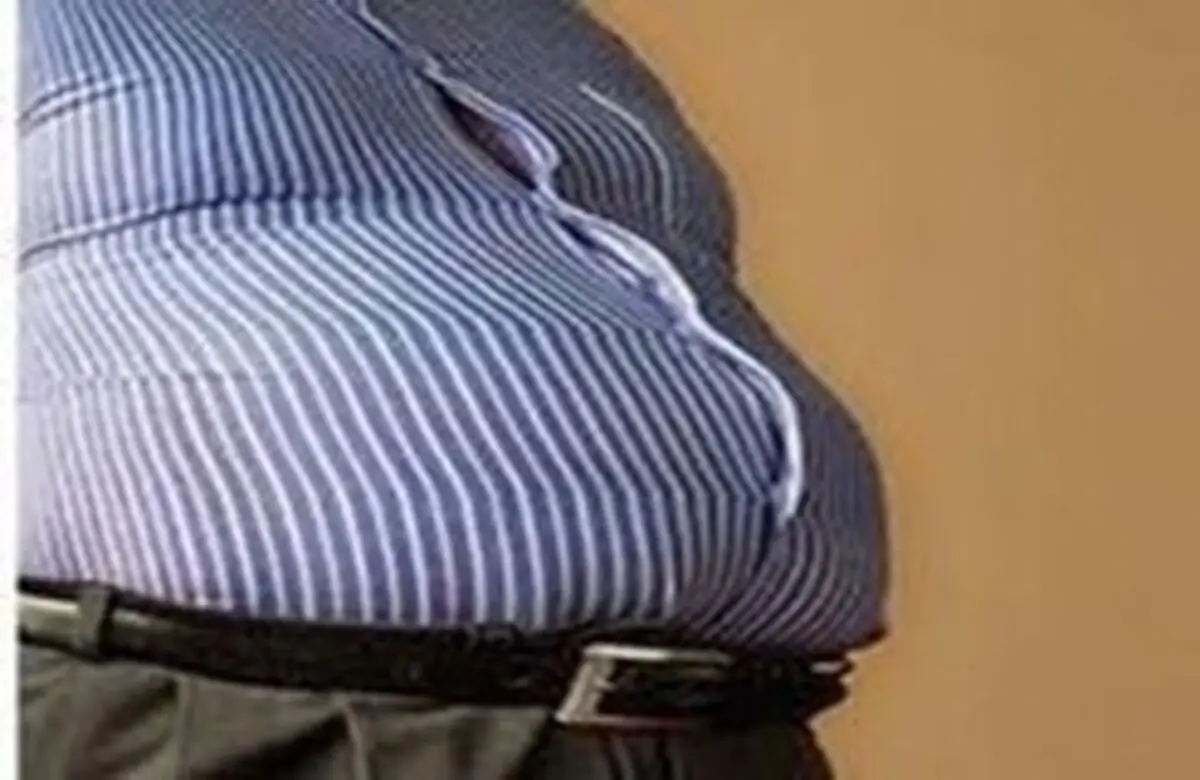 چه زمانی جراحی لاغری کارگشا است؟