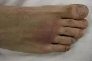 فواید عجیب قرار دادن پا در آب داغ