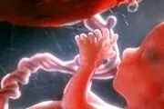 دستورالعمل تشخیص ژنتیکی 