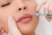 تعریف کلی تزریق ژل