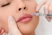 تعریف کلی تزریق ژل