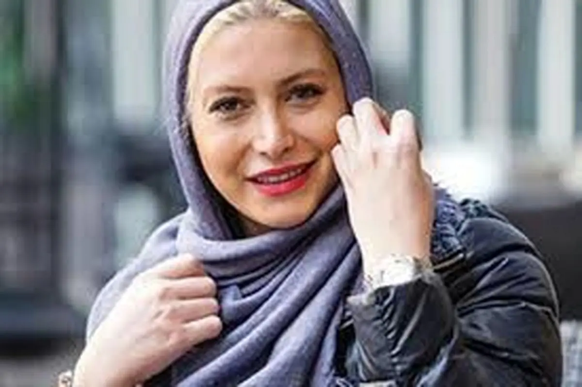 تفاوت چهره خانم بازیگر بعد از جراحی زیبایی/عکس