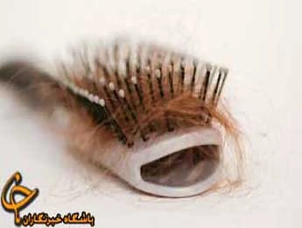 شایعترین علت ریزش مو در زنان چیست؟