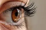 تشخیص یک بیماری نادر چشم که می‌تواند منجر به نابینایی شود
