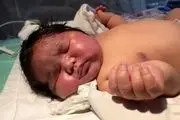 تولد نوزادی با ۶.۵ کیلوگرم وزن در مشهد
