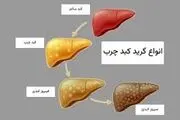 کبد چرب چند گرید دارد؟ آشنایی با انواع و علائم هر مرحله