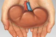 تاثیر سیگار بر سرطان کلیه