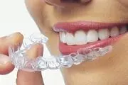 لبخندی فریبنده با ارتودنسی نامرئی