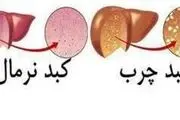 علائم و درمان کبد چرب چیست؟