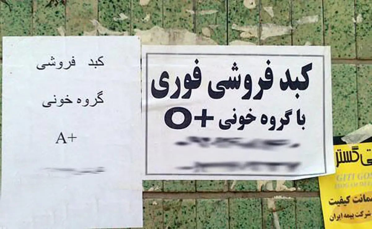 معضل خرید فروش کبد زیر پوست شهر