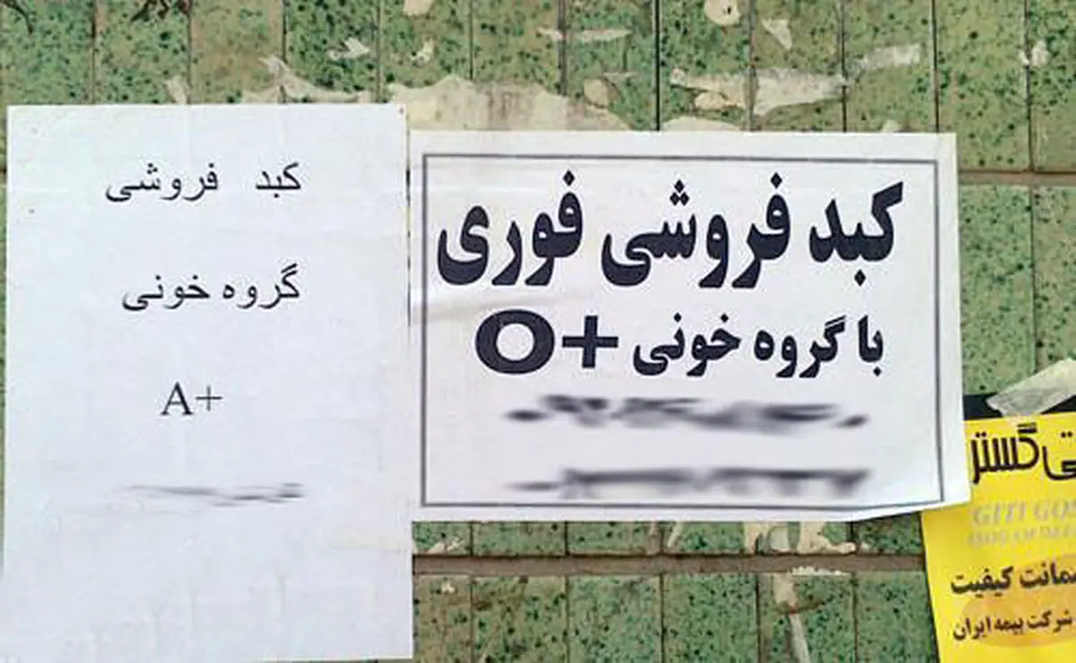 معضل خرید فروش کبد زیر پوست شهر