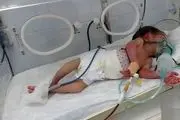 جنایات پنهان سعودیها؛ ناهنجاری های مادرزادی کودکان یمنی