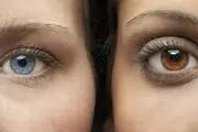 آرزوی چشم رنگی؛ انتخاب بین نابینایی و زیبایی
