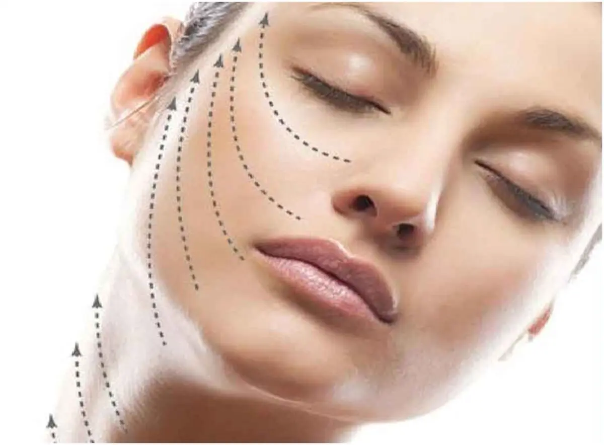 گام به گام با لیفت با نخ جدید ترین روش زیبایی صورت
