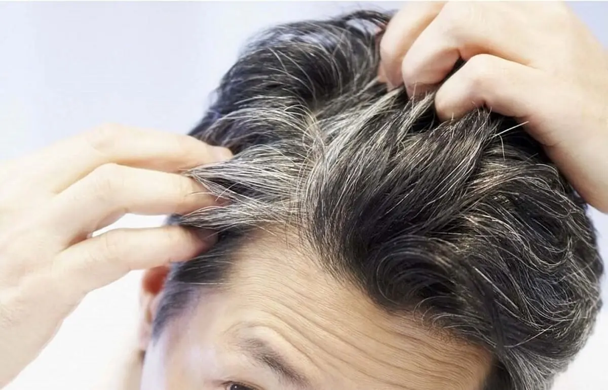 "اضطراب و استرس" باعث خاکستری شدن مو میشود