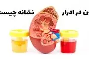 ادرار خونی نشانه چیست؟