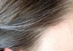 چند گام آسان برای کاهش سفیدی زودرس موی سر