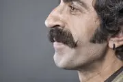 اگر بینی بزرگی دارید رژیم غذایی مادرتان در دوران بارداری مقصر است!