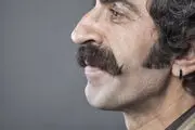 اگر بینی بزرگی دارید رژیم غذایی مادرتان در دوران بارداری مقصر است!
