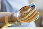 ساخت دست مصنوعی با قابلیت کار با رایانه و تلفن همراه