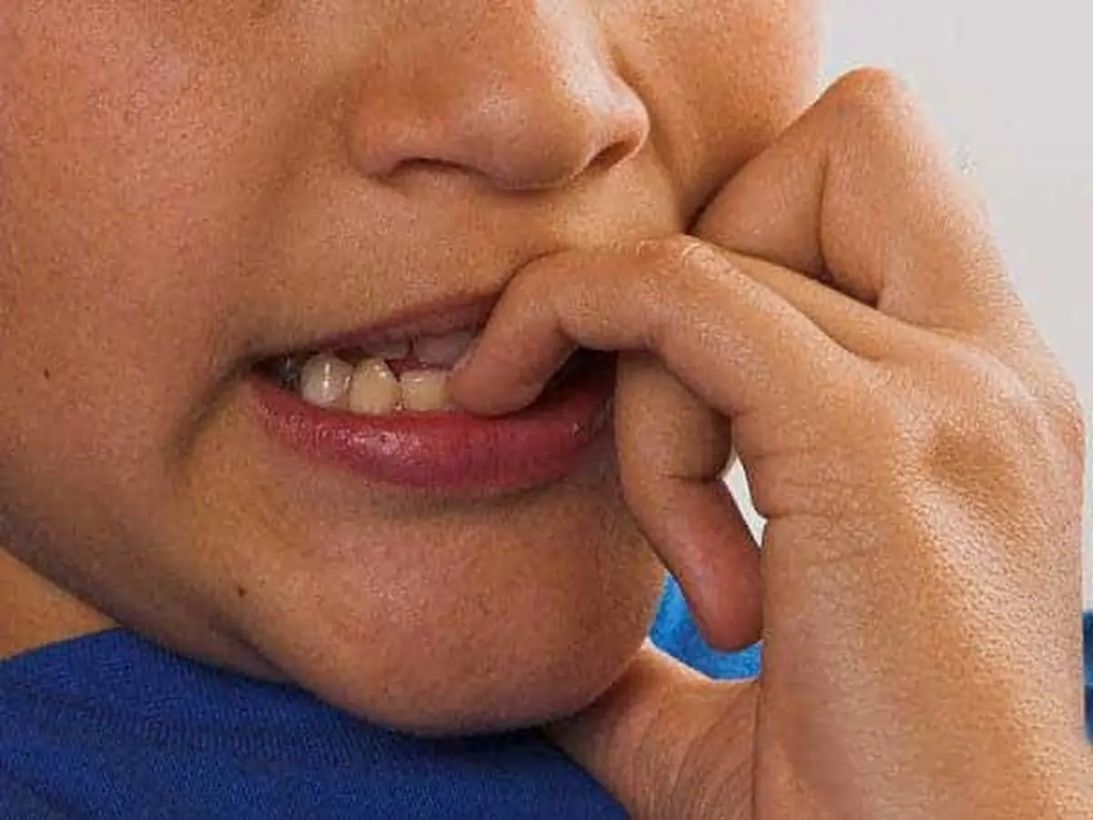آیا جویدن ناخن نوعی اختلال در سلامت روان است؟