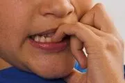 آیا جویدن ناخن نوعی اختلال در سلامت روان است؟