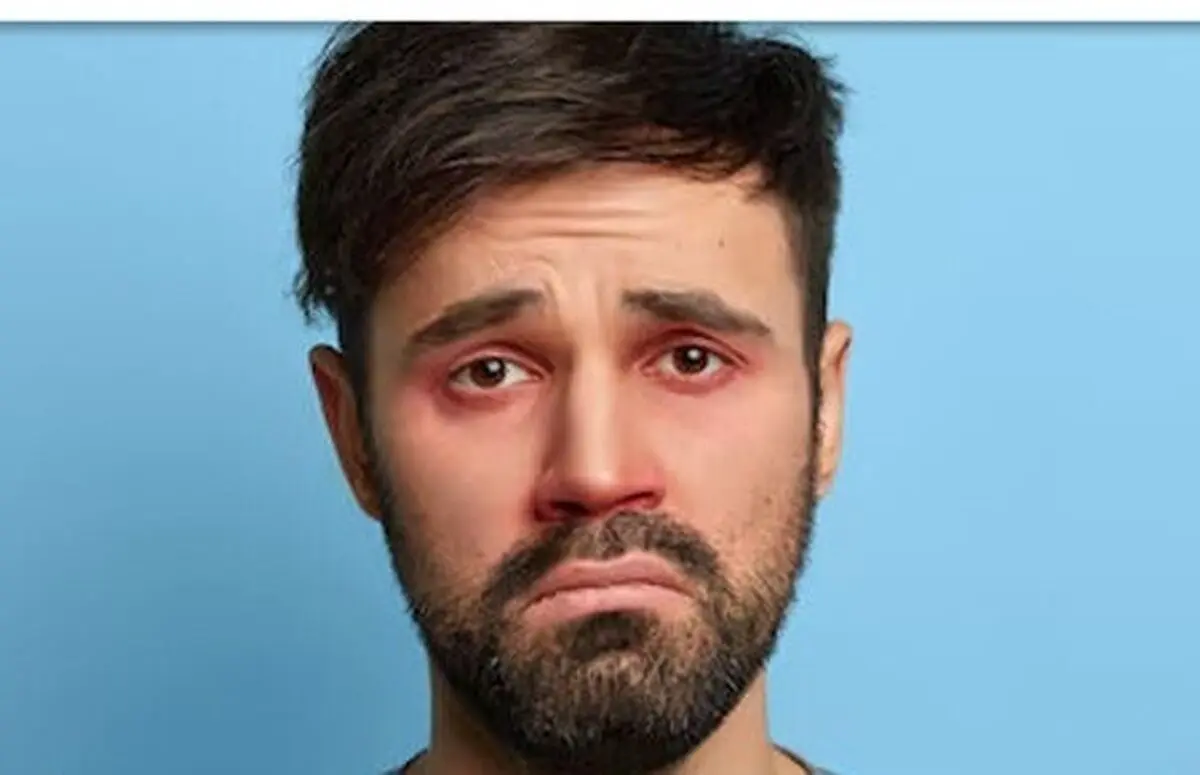 تشخیص ۱۰ بیماری از روی چهره انسان