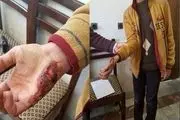 حمله سگ های ولگرد به یک نوجوان سرکانی