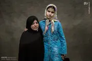 معضل ژنتیکی عجیب مردم خراسان شمالی/ عکس