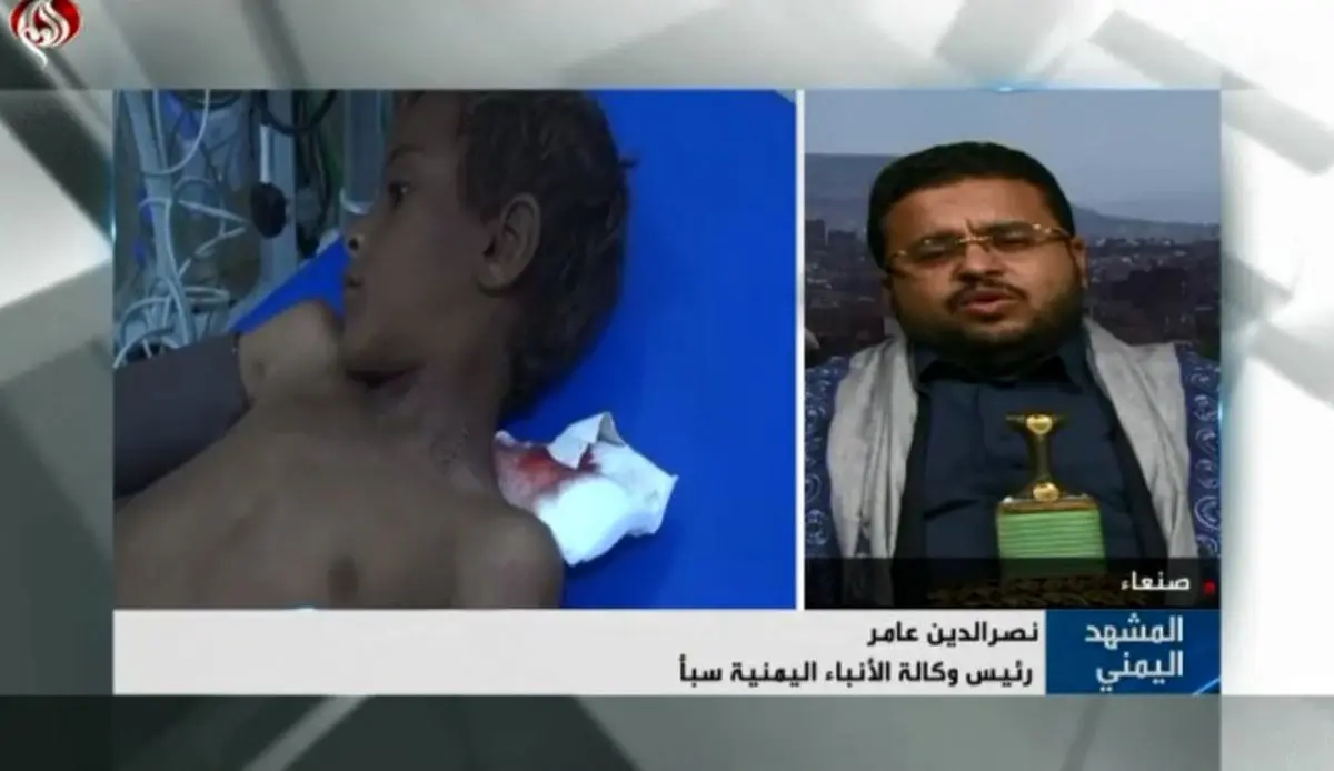 آتش بس سازمان ملل در یمن بر سر دوراهی!