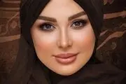 صورت نیوشا ضیغمی کبود شد!+عکس