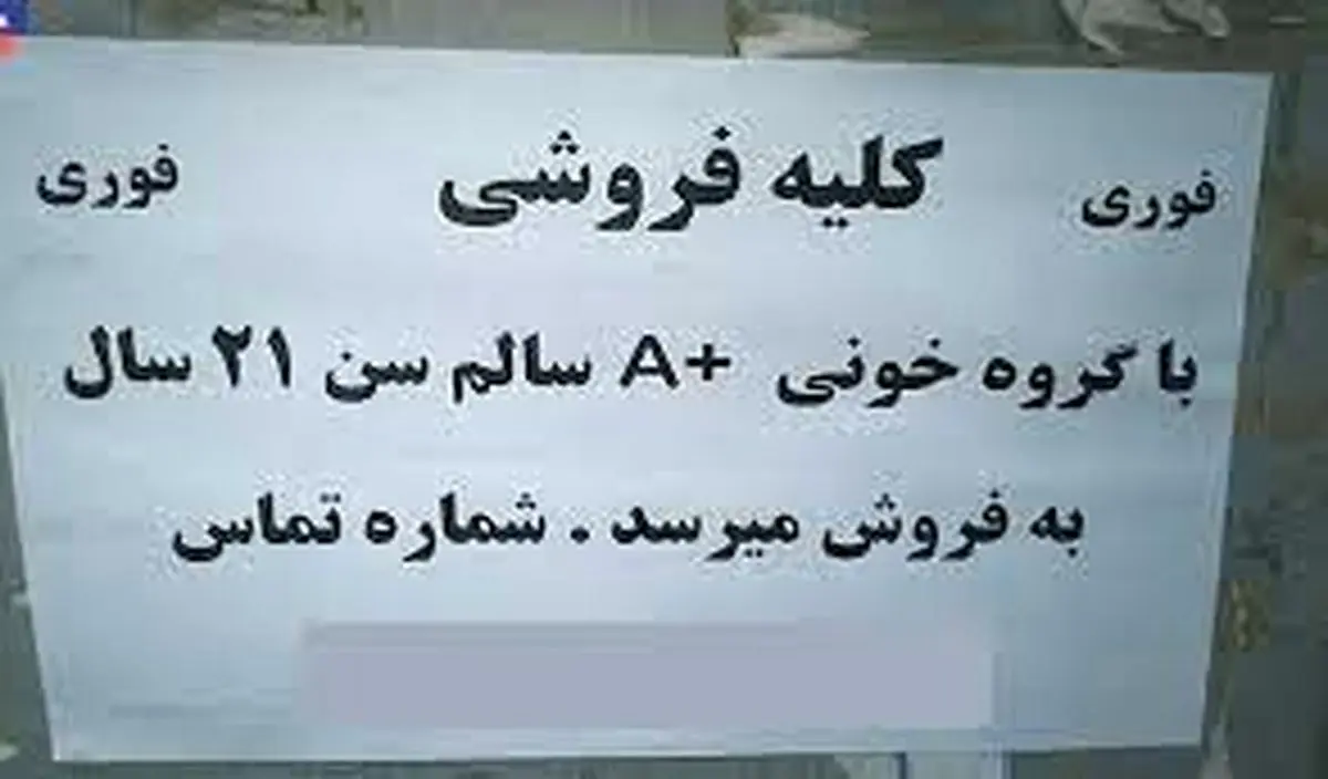 معاوضه کلیه با خودرو!