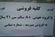 معاوضه کلیه با خودرو!