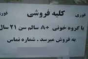 معاوضه کلیه با خودرو!